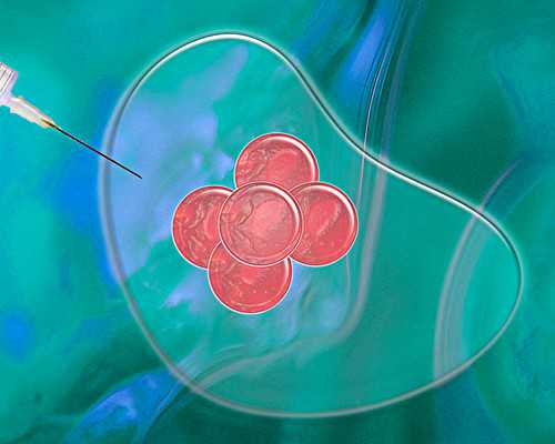 卵巢宫外孕危险吗会出血吗